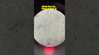 Semen Analysis.   #semenanalysis #labtechnician #laboratory #semen #viral