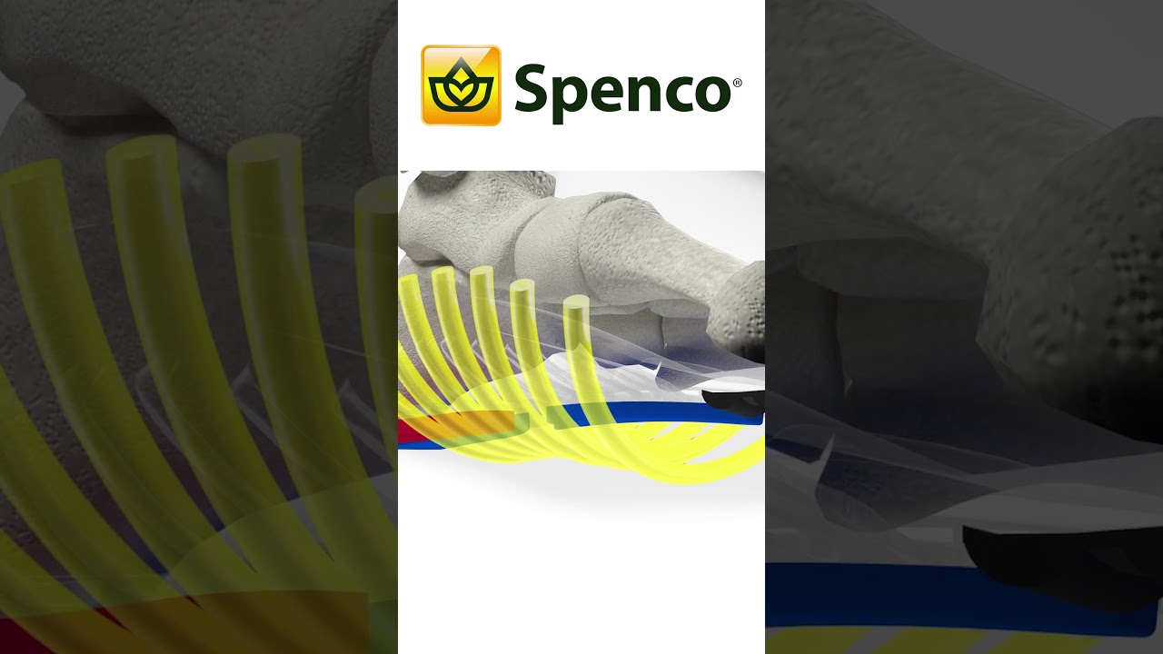 Spenco Total Support Technology InstagramFB