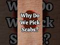 Why Do We Pick Scabs? #skincare #science #medical #aesthetic #health