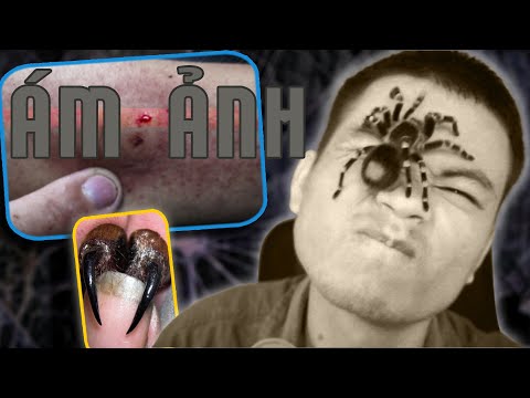 Video: Tarantula cắn