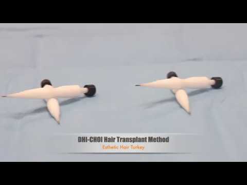 DHI(Choi) Hair Transplant Method - Esthetic Hair Turkey - YouTube