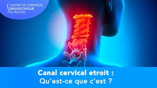Canal Cervical Étroit : Symptômes, causes et traitements