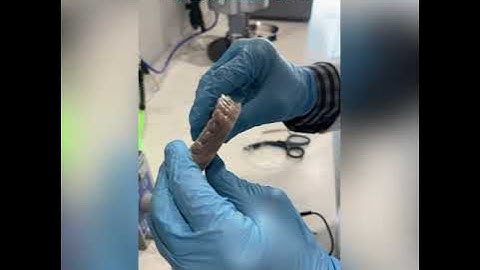 Boss Orthodontics: In-house Clear Aligner Printing and Fabrication