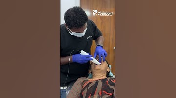 Digital Intraoral Scanning for Dental Implants – The Precision Process at Richa Cosmodent