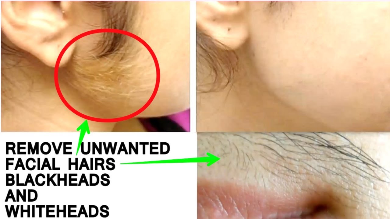 Remove Facial Hair Permanently Facial Hair Removal Mask Facial Hair Removal at Home YouTube