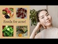 Батгатай, асуудалтай арьсны хооллолт | Foods for acne, problematic skin 🙌🏻