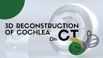 CT 3D reconstruction of cochlea