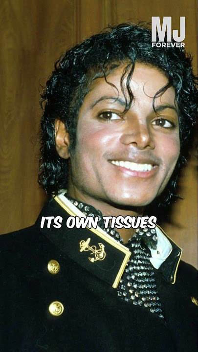 How Did Michael Jackson become White?  #shorts  #michaeljackson #kingofpop