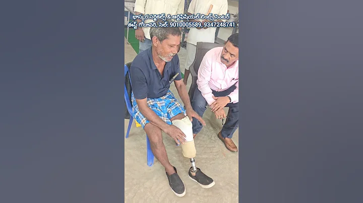 Success Story of a Below Knee Amputee After Getting a Prosthetic Limb | Bhaskara Prosthetic Care