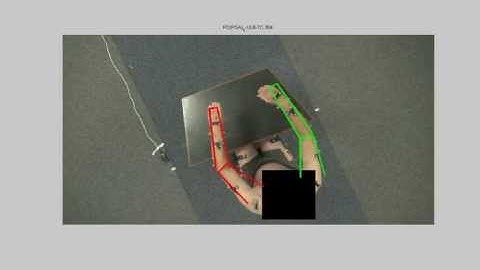 Markerless Upper Body Parts Tracking - Tremor analysis for Parkinson Disease Patients.