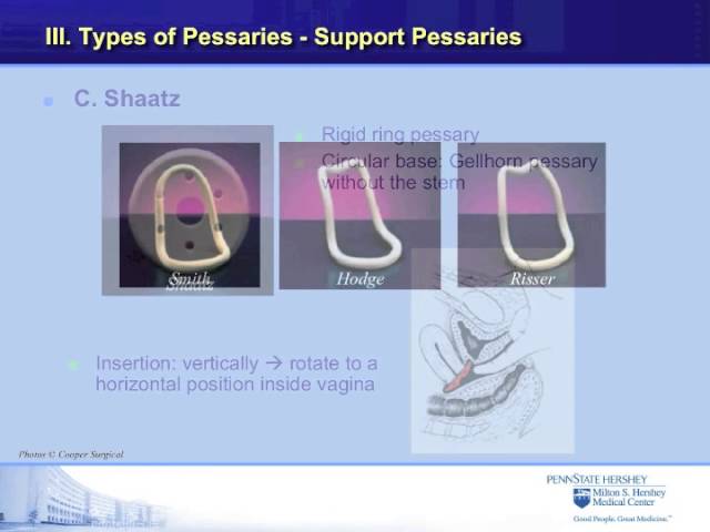 Pessaries for Treatment of Pelvic Organ Prolapse | GLOWM