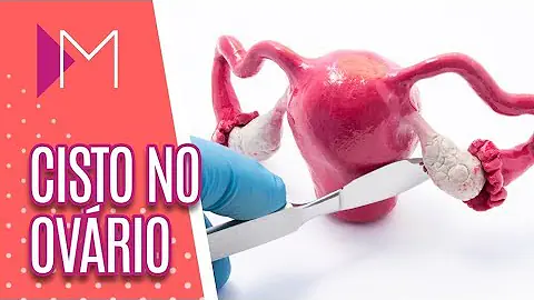 Qual o sintoma de cisto no útero?