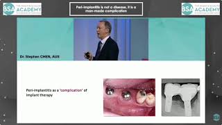 Dr. Stephen Chen on peri-implantitis