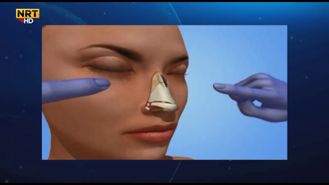 Dr. Farhad Aziz Zangana - jwankari lut  د. فەرھاد عزیز زه‌نكه‌نه‌ - جوانكاری لوت