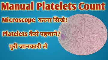 Manual Platelets count formula | Platelets count under microscope | Low Platelets | High Platelets