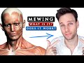 What is MEWING and does it REALLY WORK?