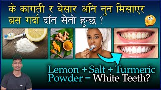 के कागती र नुनले दाँत सेतो हुन्छ/Teeth whitening home remedies/ Lemon Salt/Truth /Zirconia /Doc Taj