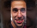 The Open Cup battle Begins