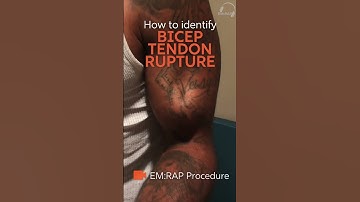 Bicep Tendon Rupture