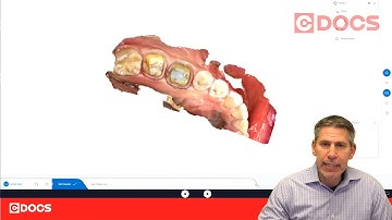 Tip of the Day: Articulator Penetration