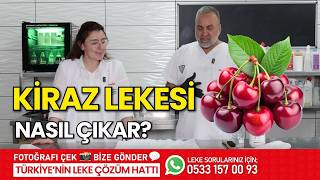 Ki̇raz Lekesi̇ Nasil Çikar? Leke Kütüphanesi̇