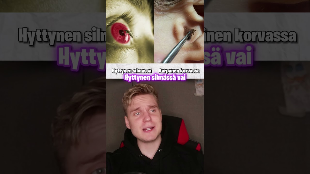 Kumpi sattuu enemmän? (osa 2)