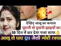 try this diy आलू से बना पैक hyper pigmentation को जड़ से खत्म कर देगा 100%👌#naturalpooja#faceglow