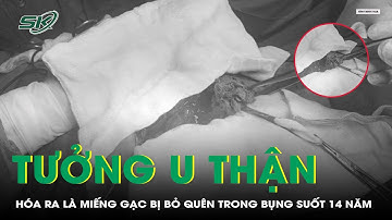Tưởng U Thận, Hóa Ra Là Miếng Gạc Bị Bỏ Quên Trong Bụng Suốt 14 Năm | SKĐS