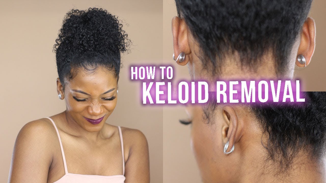 Keloid compression earrings