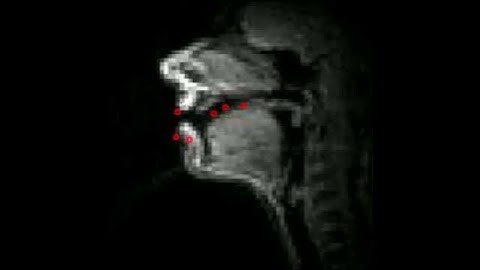 No alignment of real-time MRI video and EMA sensors