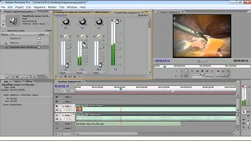 Master Class of Laparoscopic Movie Making by Dr R K Mishra