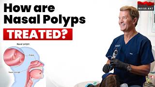 How Are Nasal Polyps Treated? ENT Doctor Explains