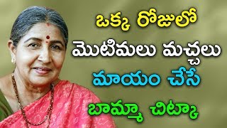 ఒక్క రోజులో మొటిమలు మచ్చలు మాయం చేసే బామ్మా చిట్కా |Home Remedy for Pimples at home| Bamma Vaidyam