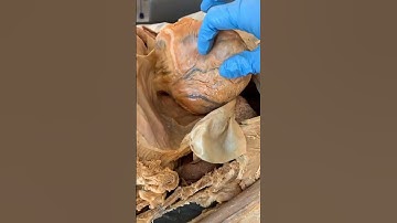 Not All Muscle Tissue Is the Same...