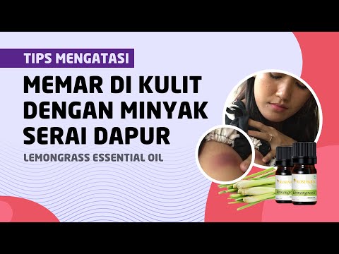 Video: Minyak Esensial Untuk Memar: Pilihan Efektivitas Dan Perawatan