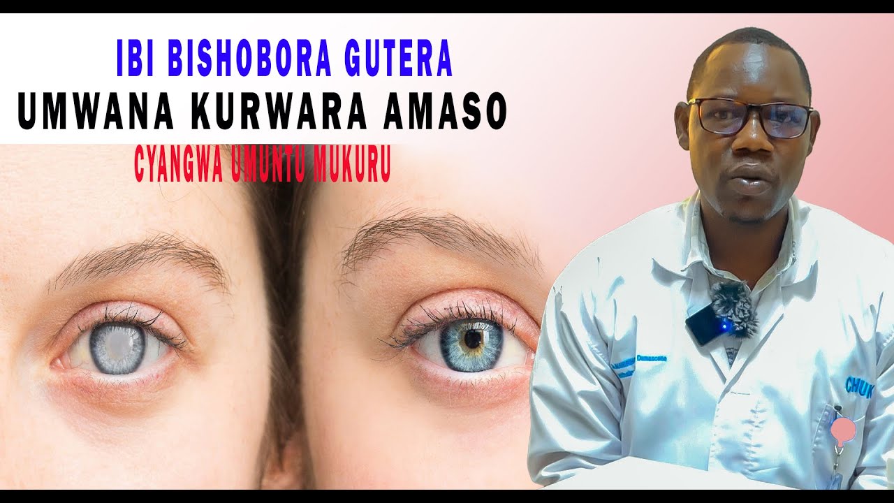 INDWARA ZA AMASO IBYO TWAKORA BIKAZIDUTERA CG TUKAZITERA ABANA TUTABIZI.