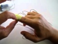 [STREAM] Broken Index Finger / Avulsion Fracture / Post-surgery