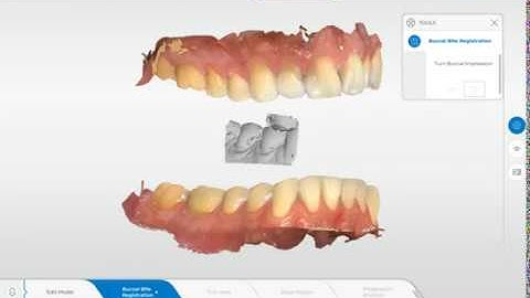 How to do a manual bite correlation in Connect software