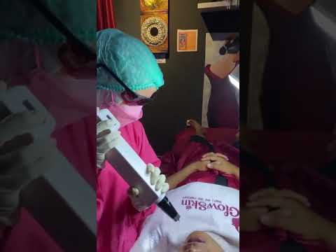 Treatment Laser Bibir
