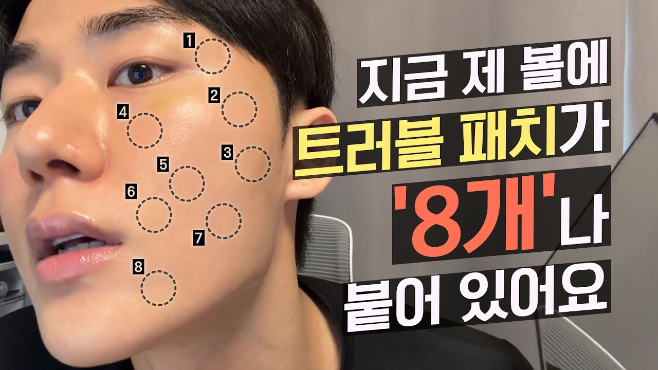 티 안나는 트러블 패치!!!!!