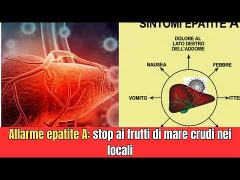 Allarme epatite A stop ai frutti di mare crudi nei locali
