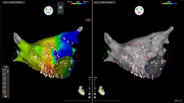Case Study: Ripple Mapping Dr. Brenyo