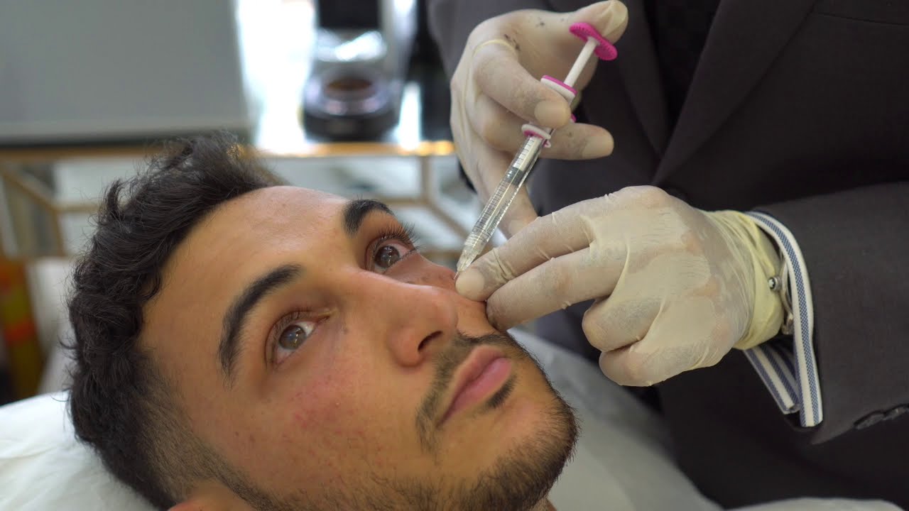 Under Eye Filler Treatment At Skin Science Clinic