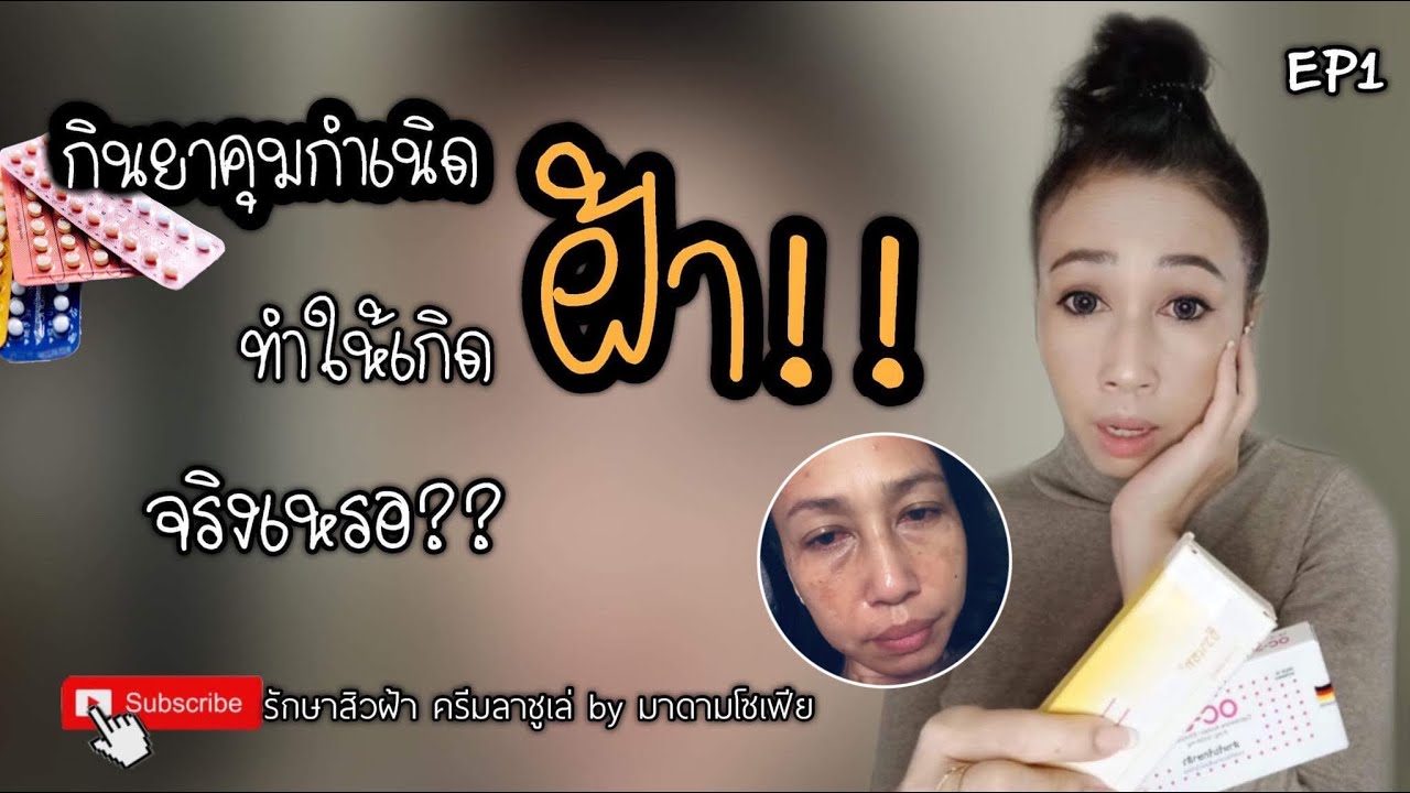 ยาคุมกำเนิด ทำให้เกิด ฝ้ากระ!! จริงเหรอ?? พบคำตอบในคลิปนี้ มาดามสาว50+| ครีมลาชูเล่