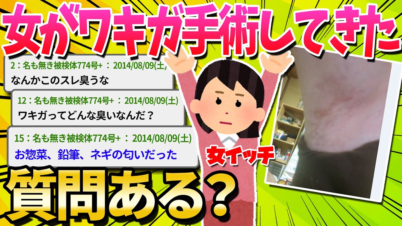 【2ch面白いスレ】女がワキガ手術受けてきたけど質問ある？【ゆっくり解説】
