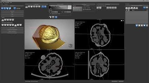 Dragonfly 3 Training Video   Visual Planes