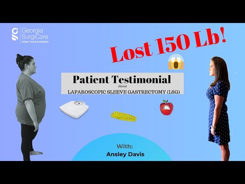 Video 150 Pounds Later: Life After Bariatric Surgery,... - youtube