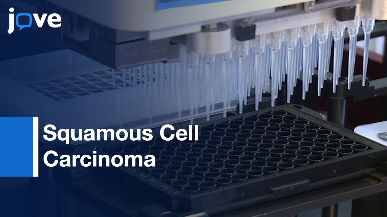 Therapy Testing in 3D Cell culture model for Squamous Cell Carcinoma | Protocol Preview