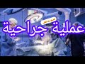 أول عملية جراحية لأطباء الجن شاهد غرائب وعجائب الجن