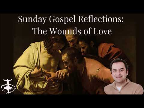 The Wounds of Love: Divine Mercy Sunday
